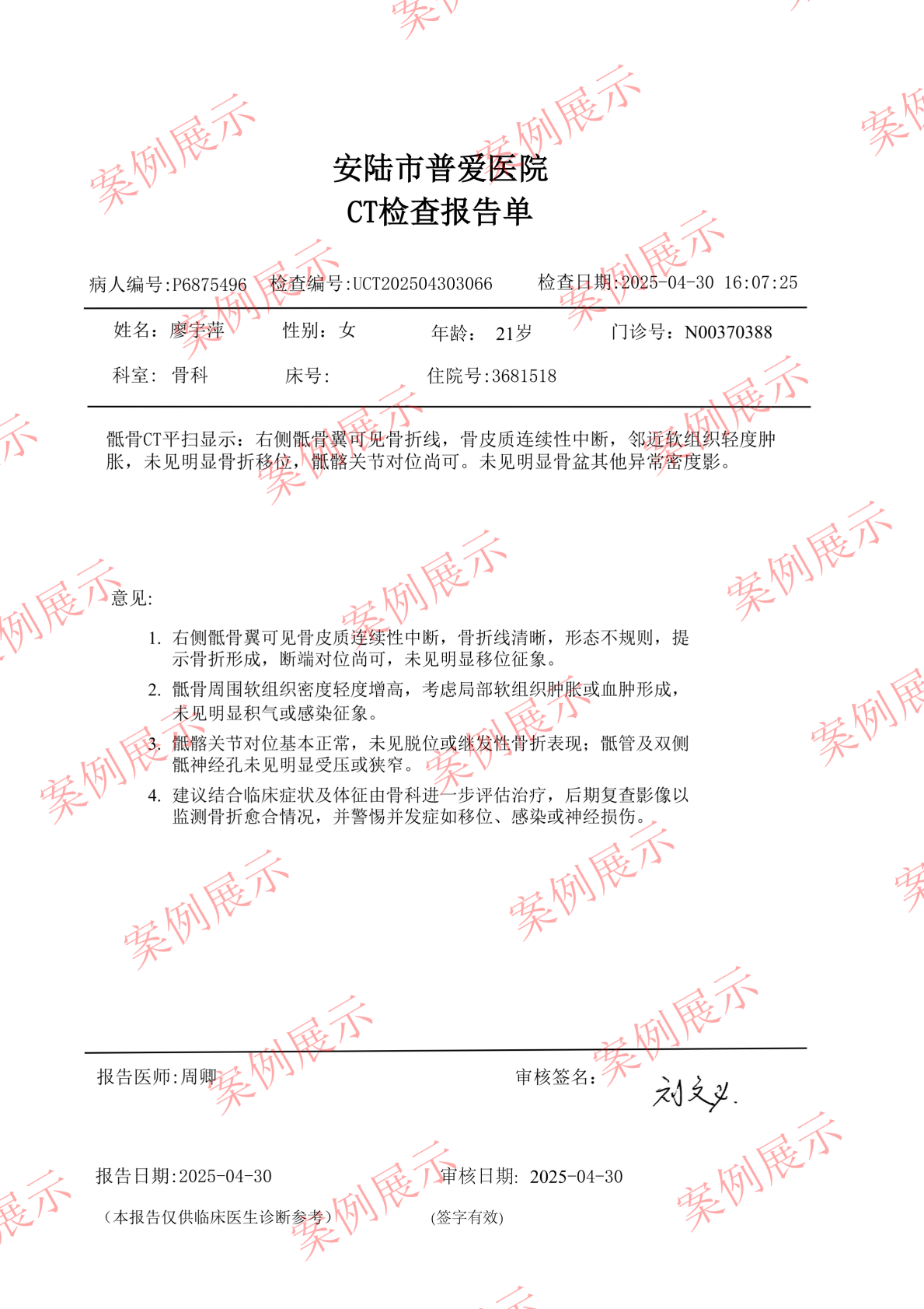 CT检查报告单_01