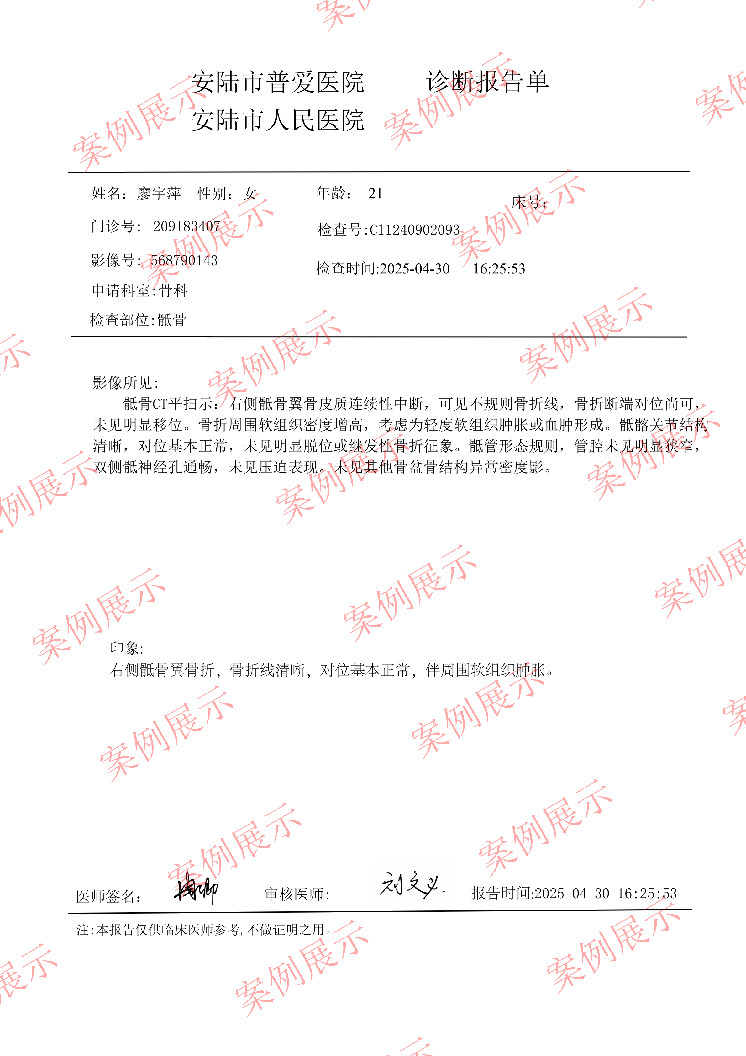 CT检查报告单_02